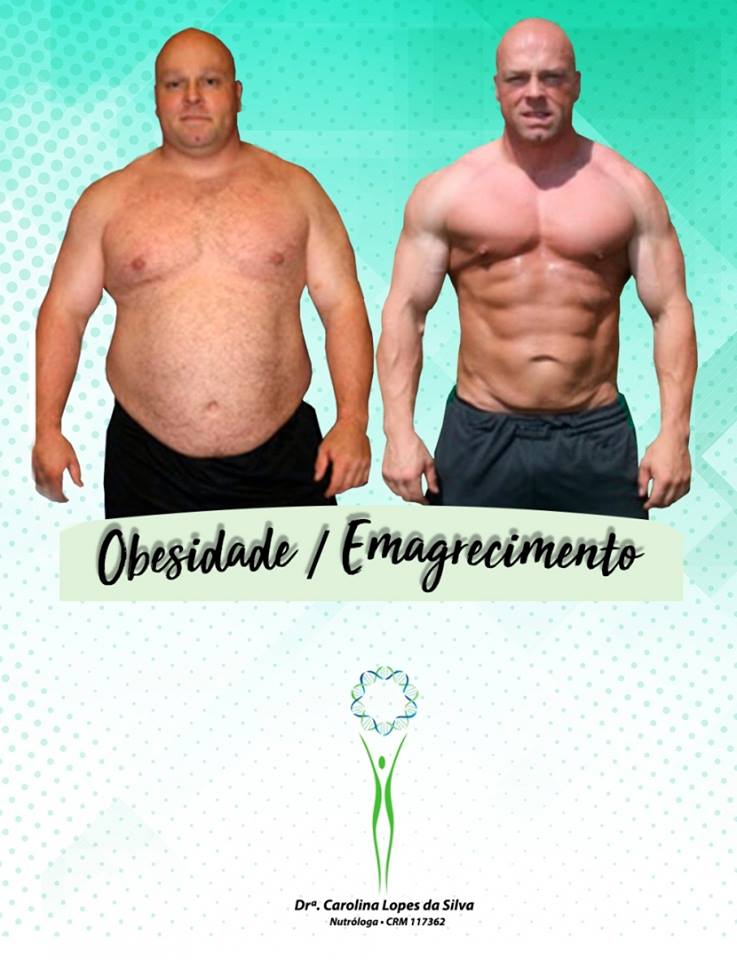 Obesidade x Emagrecimento